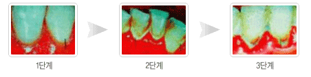 1단계, 2단계, 3단계